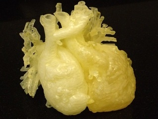 3D модели клапанов сердца