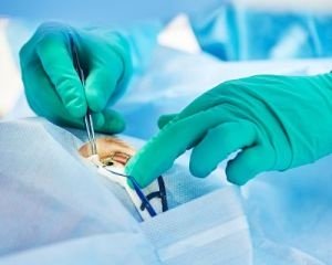 Лечение рака глаз в Израиле, цены