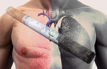 курение и рак